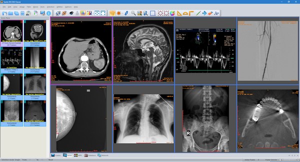 Sante DICOM Viewer(医疗办公软件)